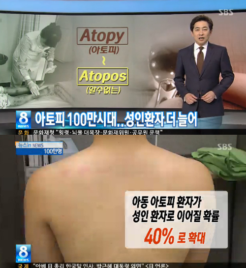 아토피의 뜻, ‘뜻을 알 수 없는’ 이유 알 수 없는 불치병? ‘예방법은’