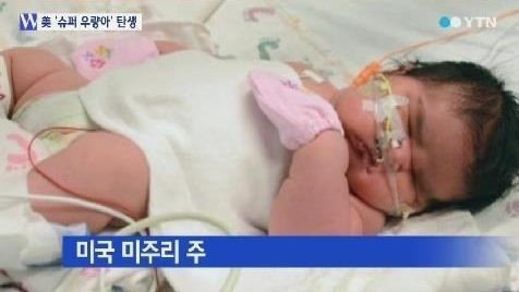 6.4kg 슈퍼 우량아, 보통 신생아의 2배 무게 ‘믿기지 않아’