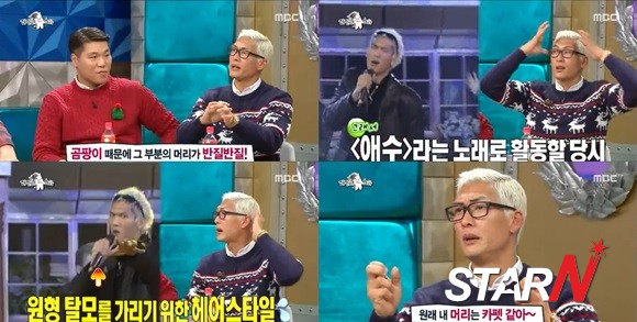 라디오스타 박준형 “‘애수’ 시절 선글라스..원형탈모 가린 것”