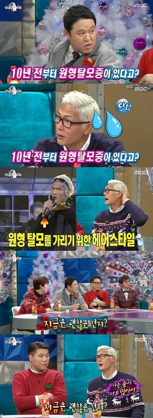 라디오스타 박준형, 애수 시절 원형탈모 가리기 위해 머리에 선글라스 착용해