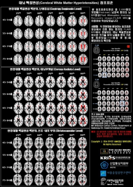 뇌경색 위험 예측지도, 내 뇌는 몇 등? ‘한국인 허혈 뇌지도’ 완성