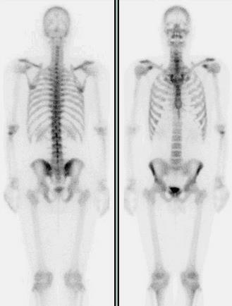 복합부위 통증증후군이란, 발목 염좌 후에도 생길 수 있어