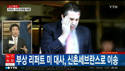 리퍼트 美대사, 김기종 우리마당 대표에게 테러당해 ‘오른 뺨 5cm 자상’