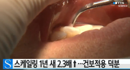 스케일링의 효과, 입냄새 많이 난다면? ‘스케일링을 하세요!’