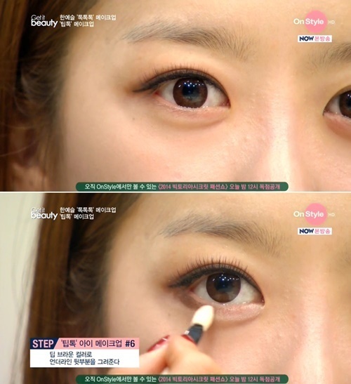 요즘 주의할 눈병, 환절기 결막염 ‘안대 착용시 증상 악화될 수 있어’