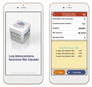 분당서울대병원, 폐암재발 가능성 예측 앱 개발