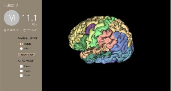 '뉴로게이저(NEUROGAZER)'는 자기공명영상(MRI)으로 뇌를 촬영, 이를 분석해 각종 정보를 제공하고 있다. 사진은 MRI 스캔을 한 사용자의 데이터를 활용해 3D로 재구성한 모습.