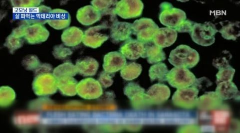 일본 식인 박테리아, 치사율 50%의 ‘막강 공포’...감염자 291명 달해