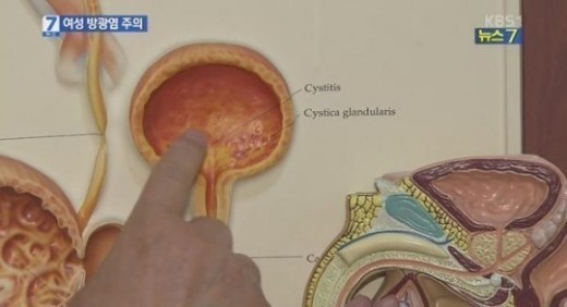 비임균성 요도염이란, 각종 ‘박테리아·바이러스’ 통해 ‘요도 입구’부터의 감염