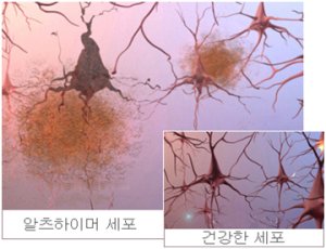 신격호 회장 서울대병원에서 어떤 검사하게 되나