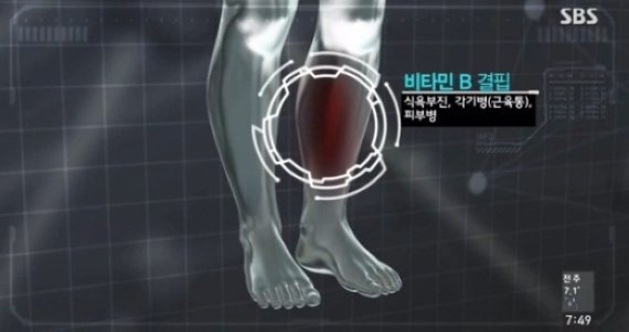 비타민B 결핍증, 예방하려면 어떻게 해야 하나?