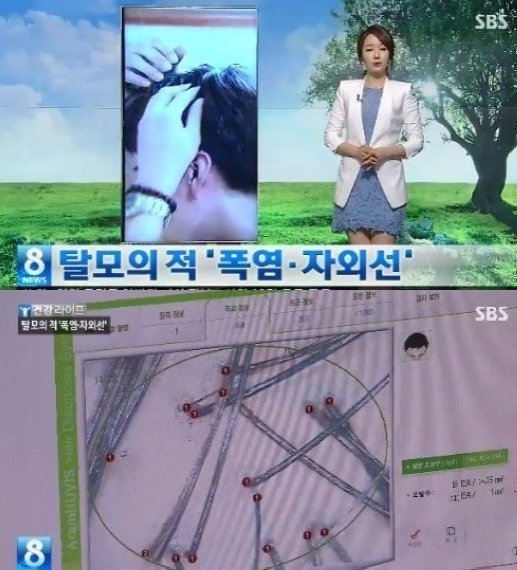 환절기 탈모 예방법, ‘폭염-자외선’ 피해라 “샴푸는 최대 몇 분?”