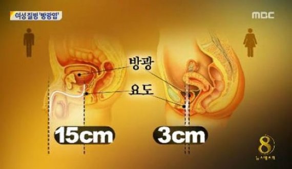 방광염 생활습관, 증상은?…‘요도+아랫배 통증’ “매일 7~8컵 물 섭취 중요”