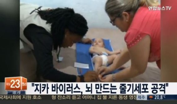 지카바이러스 뇌, 중추신경계 질환과 연관↑…“분명한 원인 결과 필요”