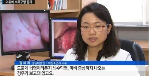 수족구병 증상, 미열-발진-식욕부진 등…“감염 예방 최선”