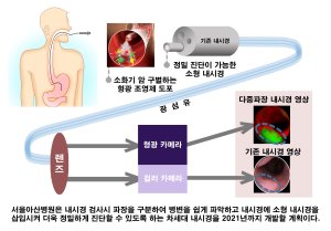 차세대 스마트 융복합 내시경