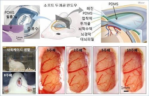 동물 뇌 수술, PDMS 소재 ‘소프트 두개골 윈도’ 개발…“장기간 깨끗하고 투명한 상태 유지”