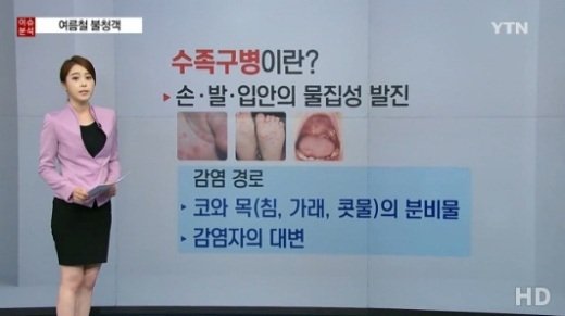 수족구 초기증상, 감기와 비슷한 증상 보이다가 물집성 발진 나타나 ‘예방법은?’