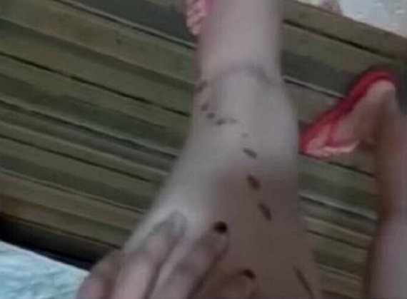 미니스커트 입은 여성만 골라 정체불명 액체 테러