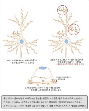 머릿 속 '신경망 가지치기' 결핍, 자폐증 원인으로 밝혀져