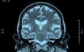 뇌는 알고 있다.. 누가 사이코패스인지