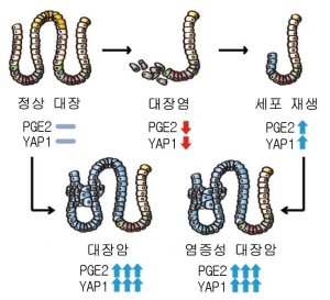 ‘대장 속 세포 재생물질’, 지나친 상호작용이 대장암 유발