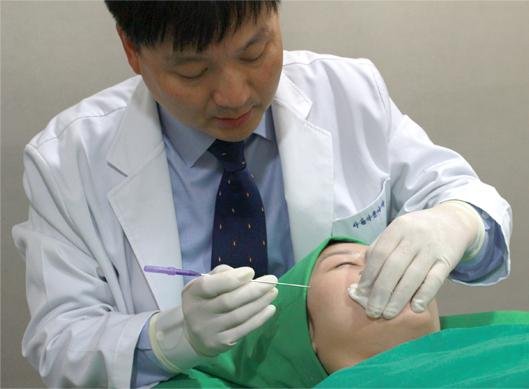 강남 아름다운나라피부과 이상준 박사가 환자에게 녹는 실 리프팅을 시술하고 있다.