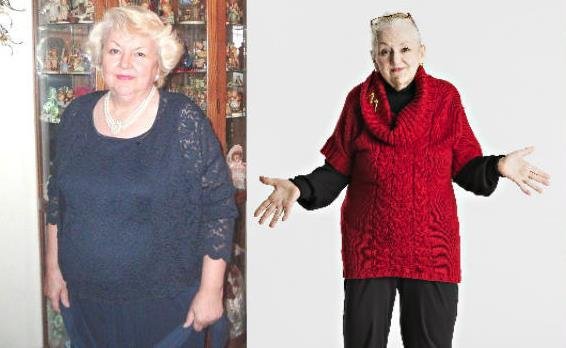 살 찌는 줄 알았는데.. 뱃속 63kg 거대 종양 제거 '성공'