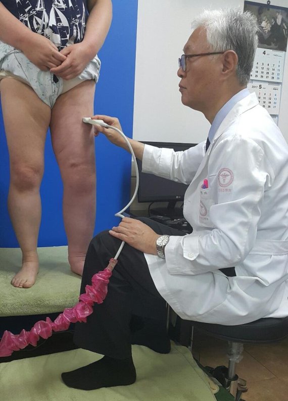 연세에스병원 심영기 원장이 림프부종 환자의 다리 상태를 체크하고 있다.