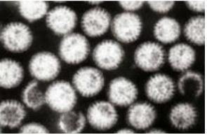 노로바이러스 입자(전자현미경 사진)