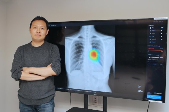 AI 스타트업 '루닛', 엑스레이 영상서 폐암진단… 정확도 98%