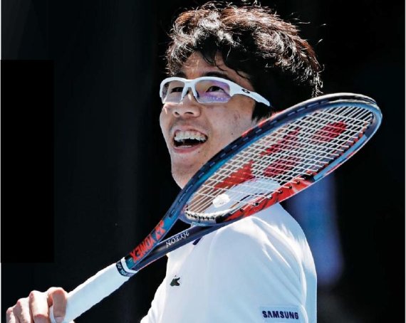 한국 테니스 최초로 메이저대회인 호주 오픈 4강에 진출한 정현 선수는 7세에 약시 판정을 받았다. 약시는 어린이 100명 중 3∼4명에게 발견될 정도로 흔하다. 연합뉴스