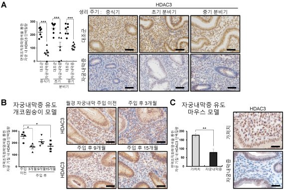 자궁내막증 환자의 자궁 내막에서 HDAC3 단백질량 감소 자궁내막증 환자(A), 개코원숭이(B), 마우스(C)의 자궁 내막 조직에서 HDAC3 단백질량 감소함을 면역조직화학염색(Immunohistochemistry)으로 확인함.