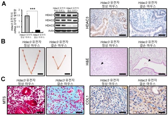 Hdac3 유전자가 결손되면 자궁의 배아 착상능 상실, 자궁조직 섬유화, 콜라겐 증가 자궁 특이적 Hdac3 유전자 결손 마우스(A)는 자궁의 배아 착상능이 상실되어 불임이 유도되고(B), 이때 자궁조직의 섬유화와 콜라겐 단백질 증가(C)가 관찰됨.
