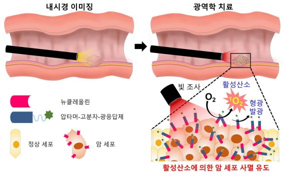 개발된 암 표적 광역학 소재를 이용한 내시경·복강경의 진단·치료 개략도 내시경/복강경을 이용하여 검진하면서 질병의심부위에 내시경에 장착된 스프레이 장치로 압타머-고분자-광응답제를 분사하면 암조직과 정상조직을 형광이미지로 구분할 수 있다. 내시경으로 압타머-고분자-광응답제를 분사한 곳에 빛을 조사하면 광응답제의 형광이 방출되어 질병 진단이 가능하고, 동시에 생성된 활성산소에 의해 광역학 치료가 가능하다.