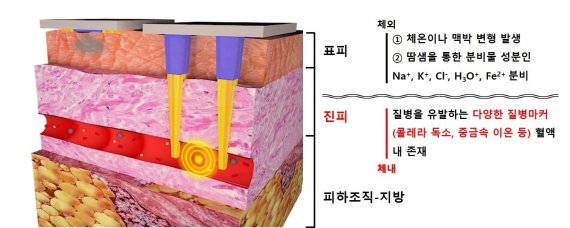 혈액 속 질병 원인 물질을 실시간 감지하는 기술 개발