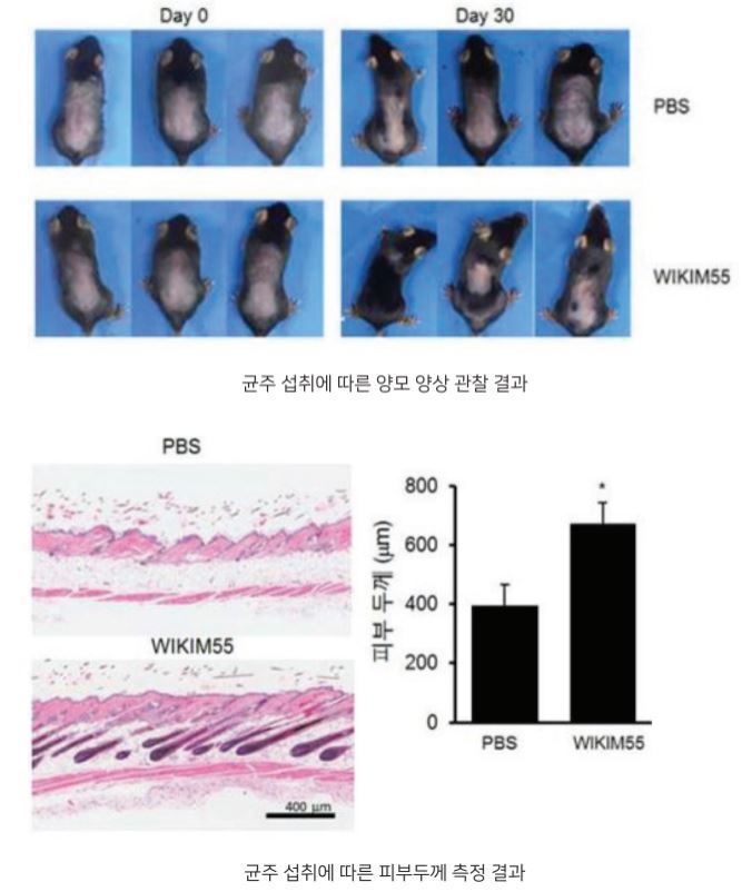 탈모로 고생한다면 반드시 먹어야 하는 음식