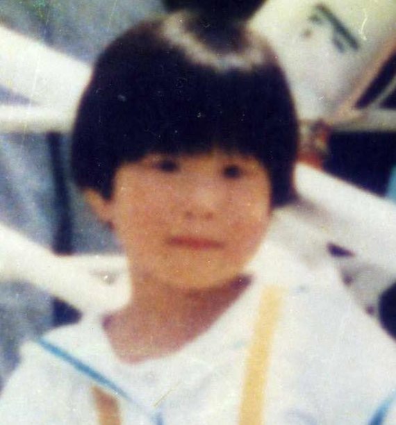 1988년 9월 1일 서울 상봉동 상봉버스터미널에서 실종된 김은신씨는 당시 볼에 꿰멘 흉터가 있었으며, 목 뒤에 검은 반점이 있다./사진=실종아동전문기관 제공