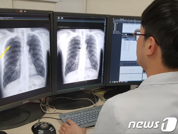 의사는 폐암 아니라는데.. 악성 폐결절 검출한 AI