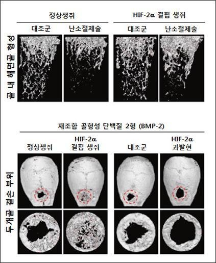 뼈 항상성 조절에 관여하는 핵심인자 발견