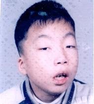 김도연(34·실종 당시 16세)씨는 지적장애 1급으로, 긴 얼굴형을 가지고 있으며 이가 고르지 못하고, 머리 우측 두피에 10cm 가량의 흉터가 있다. 실종아동전문기관 제공