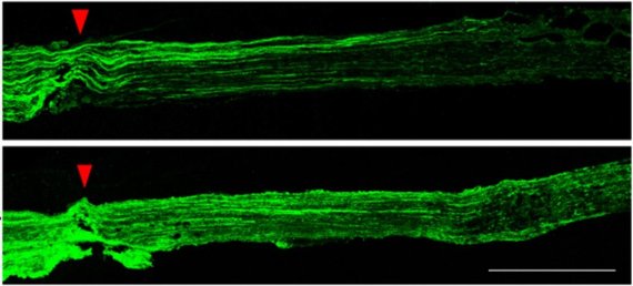 신경세포는 형광녹색으로 보이는데, Grp75 단백질이 많이 나오도록 하자 아래쪽 그림에서처럼 신경세포가 잘 재생된 것을 알 수 있다. UNIST 제공