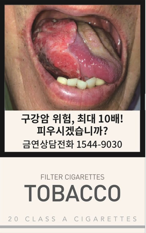 보건복지부는 담뱃갑 경고그림 및 문구 표기면적을 확대하고 금연지도원 직무범위를 확대하는‘국민건강증진법 시행령’ 개정안을 마련한다. 담뱃갑 경고그림을 현행 50%에서 75%확대한 모습. 보건복지부 제공