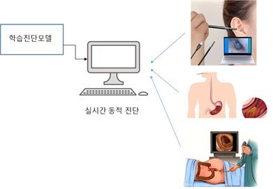 세계 최초 내시경 데이터 증강기법을 이용한 후두암 조기진단 플랫폼 개발