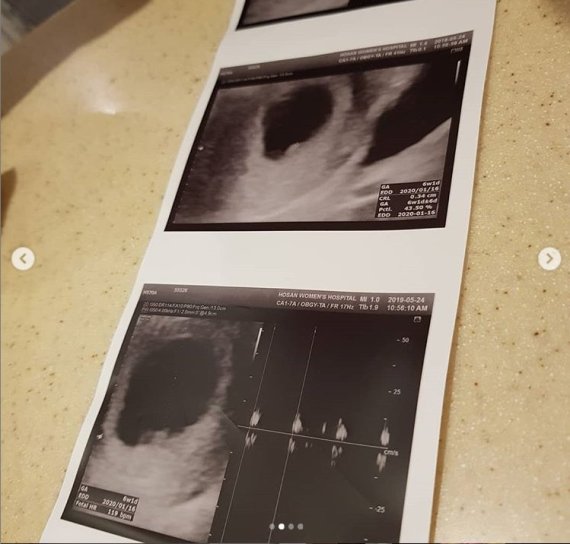 박슬기 SNS © 뉴스1