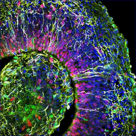 이 사진은 대뇌 피질 판의 초기 형성을 보여주는 뇌 오가노이드의 단면이다. 각 색상은 서로 다른 유형의 뇌 세포를 나타내고 있다. 캘리포니아대학 제공