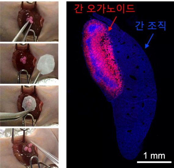 일반 세포보다 수백 배 큰 간 조직 유사체인 간 오가노이드를 쥐의 간 조직 위에 얹고 하이드로젤 테이프로 붙이는 방식을 통해 새로운 오가노이드 전달 방법을 구축했다. 사진은 이식한 간 오가노이드가 간 조직의 일부로 살아 붙어 있음을 보여주고 있다. 연구재단 제공