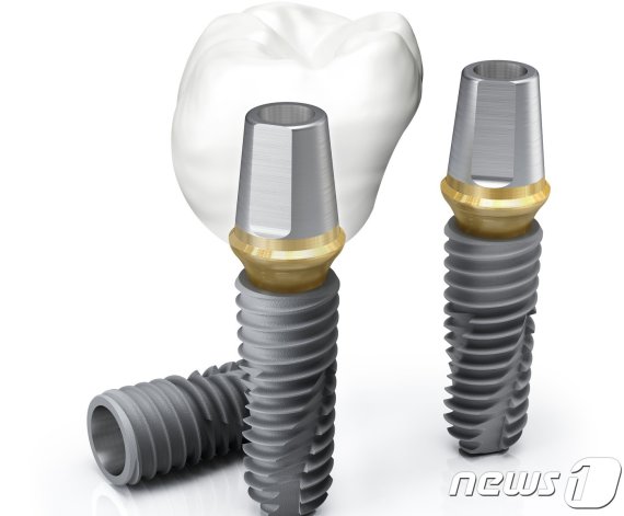 오스템임플란트가 전세계 판매량 1위를 달성한 임플란트 픽스쳐 제품.© 뉴스1