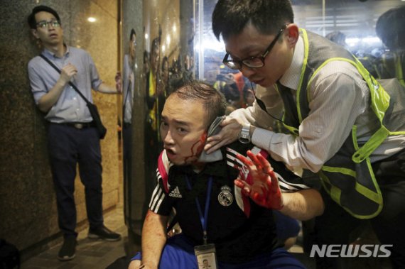 【홍콩=AP/뉴시스】지난 3일 홍콩의 쇼핑몰에서 흉기를 휘두르던 한 남자에게 귀를 물어뜯긴 앤드루 치우 구의원이 피를 흘리며 응급 처치를 받고 있다. 2019.11.05