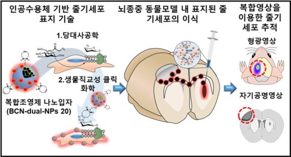 복합조영제 나노입자가 표지된 줄기세포의 추적 영상 기술의 모식도. 한국과학기술연구원 제공